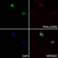 3 - Anti-PSO Antibody AP60910