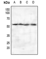 1 - Anti-PSO Antibody AP60910