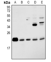 1 - Anti-RAP2B Antibody AP60911