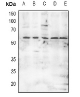 1 - Anti-MNK2 (Phospho-T249) Antibody AP60915