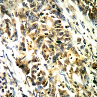 19 - Anti-LAT (Phospho-Y161) Antibody AP60916