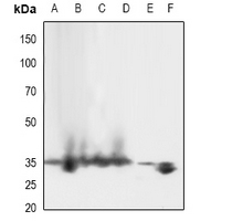 1 - Anti-LAT (Phospho-Y161) Antibody AP60916