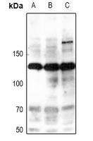 1 - Anti-iNOS (Phospho-Y151) Antibody AP60917