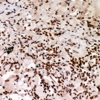 19 - Anti-HP1 alpha (Phospho-S92) Antibody AP60919
