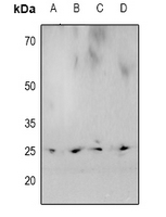 1 - Anti-HP1 alpha (Phospho-S92) Antibody AP60919