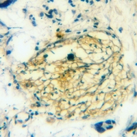 19 - Anti-nNOS (Phospho-S1417) Antibody AP60920