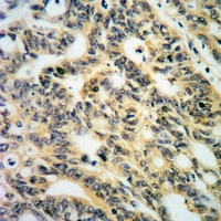 19 - Anti-PKC alpha (Phospho-S657) Antibody AP60921