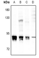 1 - Anti-PKC alpha (Phospho-S657) Antibody AP60921