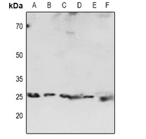 1 - Anti-HP1 alpha Antibody AP60922