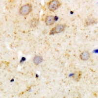 19 - Anti-PKC alpha Antibody [KO/KD Validated] AP60924