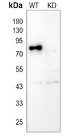 0 - Anti-PKC alpha Antibody [KO/KD Validated] AP60924