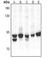 1 - Anti-PKC alpha Antibody [KO/KD Validated] AP60924