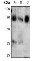 1 - Anti-SMAD4 (Phospho-T276) Antibody AP60925
