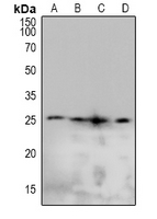 1 - Anti-Caveolin 2 (Phospho-Y19) Antibody AP60927
