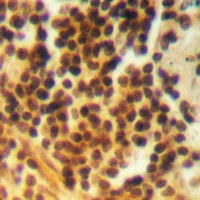 19 - Anti-BRK (Phospho-Y342) Antibody AP60929