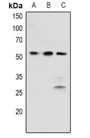 1 - Anti-BRK (Phospho-Y342) Antibody AP60929