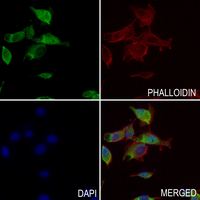 3 - Anti-DAP Kinase 1 (Phospho-S736) Antibody AP60930