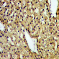 19 - Anti-DAP Kinase 1 (Phospho-S736) Antibody AP60930