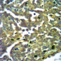 19 - Anti-TBK1 (Phospho-S172) Antibody AP60931