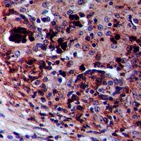 19 - Anti-ZAK (Phospho-S165) Antibody AP60932