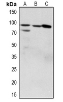 1 - Anti-ZAK (Phospho-S165) Antibody AP60932