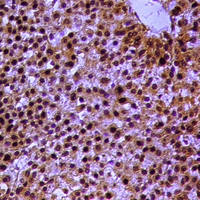 19 - Anti-RXR alpha (Phospho-S260) Antibody AP60933