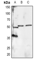 1 - Anti-RXR alpha (Phospho-S260) Antibody AP60933