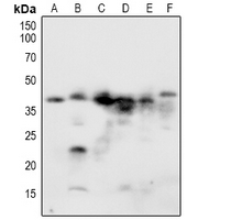 1 - Anti-NACA1 (Phospho-S43) Antibody AP60934