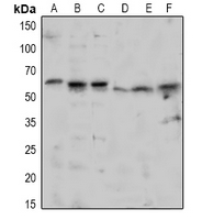 1 - Anti-TAB1 (Phospho-S438) Antibody AP60935