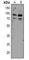 1 - Anti-TORC2 (Phospho-S171) Antibody AP60936