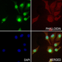 3 - Anti-ETS1 (Phospho-S251) Antibody AP60937