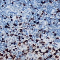 19 - Anti-ETS1 (Phospho-S251) Antibody AP60937