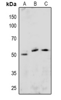 1 - Anti-ETS1 (Phospho-S251) Antibody AP60937