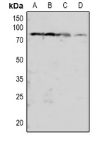 1 - Anti-PKC beta (Phospho-T641) Antibody AP60938