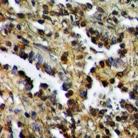 19 - Anti-ZAK Antibody AP60939