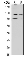 1 - Anti-ZAK Antibody AP60939