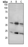 1 - Anti-LAT Antibody AP60940