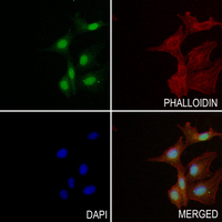 3 - Anti-NACA1 Antibody AP60941
