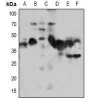 1 - Anti-NACA1 Antibody AP60941