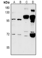 1 - Anti-CLIC6 Antibody AP60944