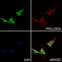 3 - Anti-CSGLCAT Antibody AP60945