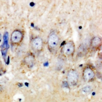 19 - Anti-CSGLCAT Antibody AP60945