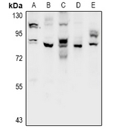 1 - Anti-CSGLCAT Antibody AP60945