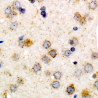 19 - Anti-CHSY1 Antibody AP60946