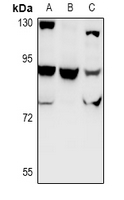 1 - Anti-CHSY1 Antibody AP60946