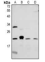 1 - Anti-CMTM6 Antibody AP60947