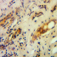 19 - Anti-RNF144B Antibody AP60952