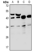1 - Anti-RNF144B Antibody AP60952