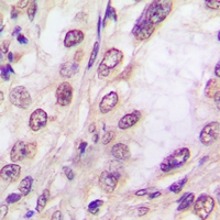 19 - Anti-EIF2AK1 Antibody AP60958