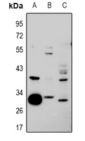 1 - Anti-hnRNP CL1 Antibody AP60961